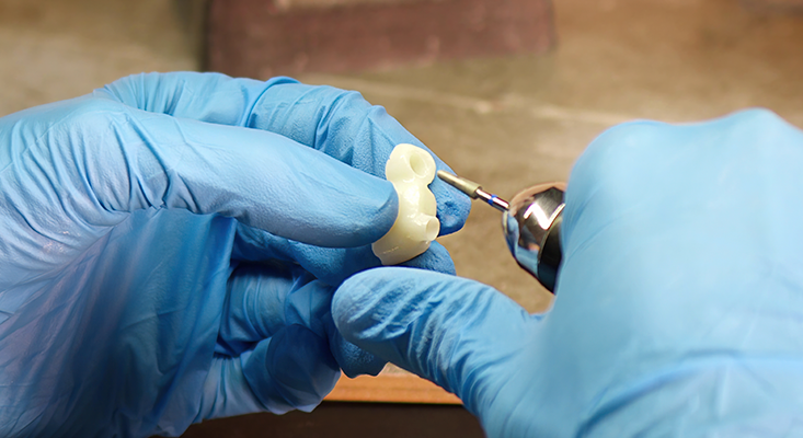 Crown Removal: Safe and Painless Techniques for Crown Replacement